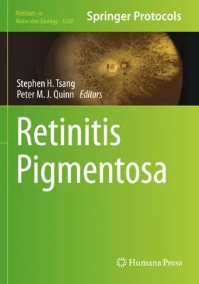 Tsang / Quinn |  Retinitis Pigmentosa | Buch |  Sack Fachmedien