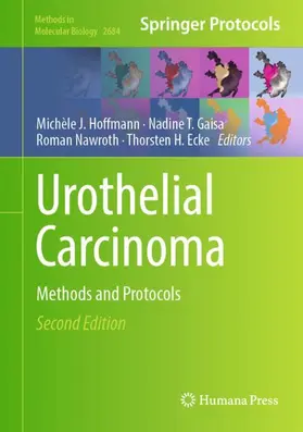 Hoffmann / Ecke / Gaisa |  Urothelial Carcinoma | Buch |  Sack Fachmedien