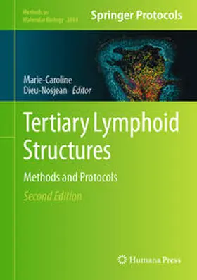 Dieu-Nosjean |  Tertiary Lymphoid Structures | eBook | Sack Fachmedien