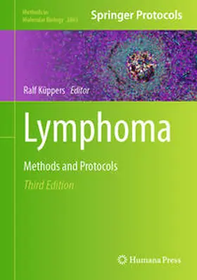 Küppers |  Lymphoma | eBook | Sack Fachmedien