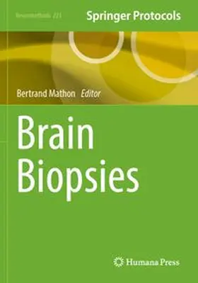 Mathon |  Brain Biopsies | Buch |  Sack Fachmedien