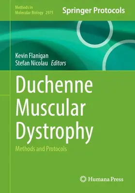 Flanigan / Nicolau |  Duchenne Muscular Dystrophy | Buch |  Sack Fachmedien