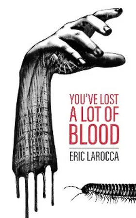 Larocca |  You've Lost a Lot of Blood | eBook | Sack Fachmedien
