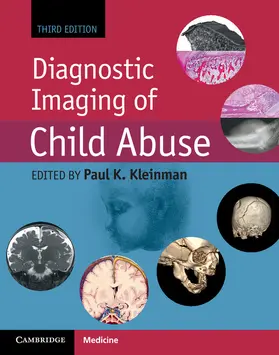Kleinman | Diagnostic Imaging of Child Abuse | Buch | 978-1-107-01053-6 | www.sack.de