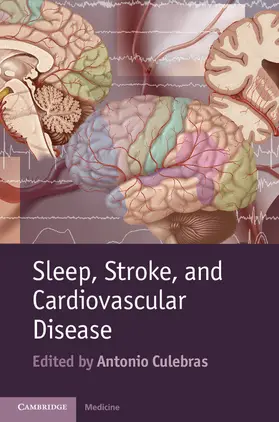 Culebras |  Sleep, Stroke and Cardiovascular Disease | Buch |  Sack Fachmedien