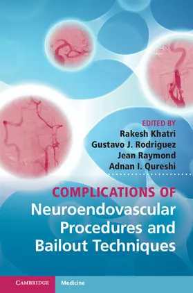 Khatri / Rodriguez / Raymond |  Complications of Neuroendovascular Procedures and Bailout Techniques | Buch |  Sack Fachmedien