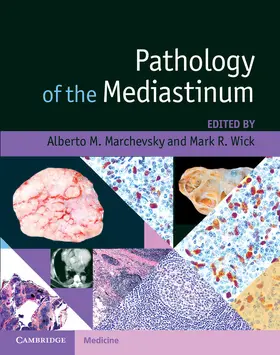 Marchevsky / Wick |  Pathology of the Mediastinum | Buch |  Sack Fachmedien