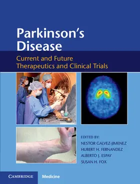 Galvez-Jimenez / Gálvez-Jiménez / Fernandez |  Parkinson's Disease | Buch |  Sack Fachmedien