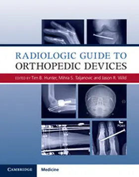Hunter / Taljanovic / Wild | Radiologic Guide to Orthopedic Devices | Buch | 978-1-107-08562-6 | www.sack.de