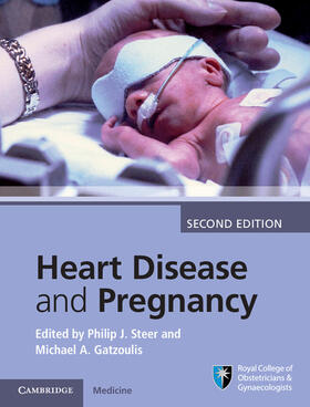 Steer / Gatzoulis | Heart Disease and Pregnancy | Buch | 978-1-107-09594-6 | sack.de