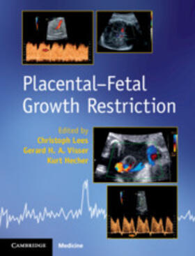 Lees / Visser / Hecher | Placental-Fetal Growth Restriction | Buch | 978-1-107-10139-5 | sack.de