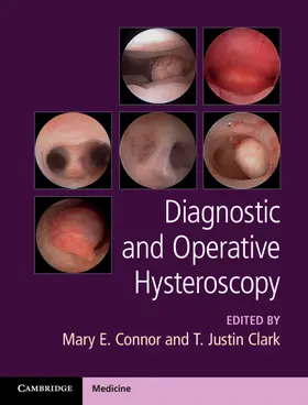 Connor / Clark |  Diagnostic and Operative Hysteroscopy | Buch |  Sack Fachmedien