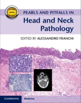 Franchi | Pearls and Pitfalls in Head and Neck Pathology with Online Resource | Buch | 978-1-107-12349-6 | www.sack.de