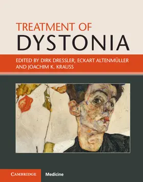 Dressler / Altenmüller / Krauss |  Treatment of Dystonia | Buch |  Sack Fachmedien