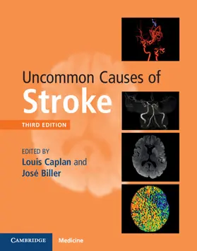 Caplan / Biller | Uncommon Causes of Stroke | Buch | 978-1-107-14744-7 | sack.de