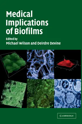 Wilson / Devine |  Medical Implications of Biofilms | Buch |  Sack Fachmedien