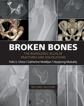 Chew / Maldijan / Mulcahy |  Broken Bones | Buch |  Sack Fachmedien