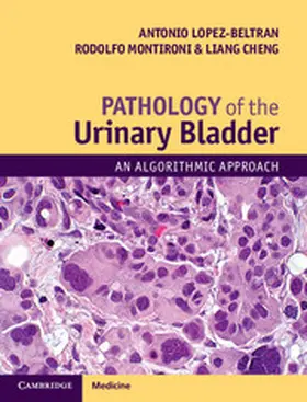 Lopez-Beltran / Montironi / Cheng |  Pathology of the Urinary Bladder | Buch |  Sack Fachmedien
