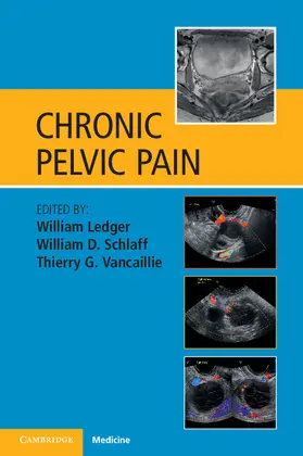 Ledger / Schlaff / Vancaillie |  Chronic Pelvic Pain | Buch |  Sack Fachmedien