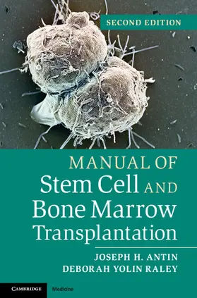 Antin / Yolin Raley | Manual of Stem Cell and Bone Marrow Transplantation | Buch | 978-1-107-66154-7 | www.sack.de