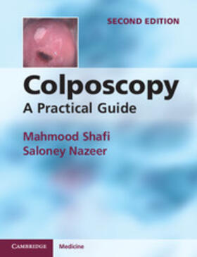 Shafi / Nazeer | Colposcopy | Buch | 978-1-107-66782-2 | sack.de
