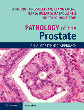 Lopez-Beltran / Cheng / Montironi | Pathology of the Prostate: An Algorithmic Approach | Buch | 978-1-108-18566-0 | sack.de