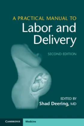 Deering |  A Practical Manual to Labor and Delivery | Buch |  Sack Fachmedien