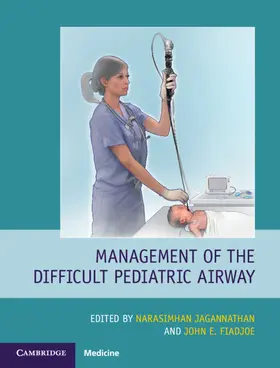 Jagannathan / Fiadjoe | Management of the Difficult Pediatric Airway | Buch | 978-1-108-49258-4 | sack.de