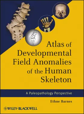Barnes |  Atlas of Developmental Field Anomalies of the Human Skeleton | Buch |  Sack Fachmedien