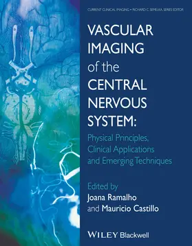 Ramalho / Castillo | Vascular Imaging of the Central Nervous System | Buch | 978-1-118-18875-0 | www.sack.de