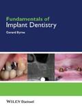 Byrne |  Fundamentals of Implant Dentistry | eBook | Sack Fachmedien