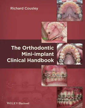 Cousley |  Orthodontics Mini Implant Clin | Buch |  Sack Fachmedien