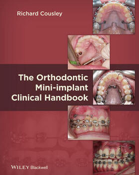 Cousley | Orthodontics Mini Implant Clin | Buch | 978-1-118-27599-3 | sack.de