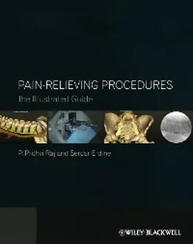 Raj / Erdine | Pain-Relieving Procedures | E-Book | sack.de