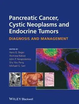 Beger / Nakao / Neoptolemos |  Pancreatic Cancer, Cystic Neoplasms and Endocrine Tumors | eBook | Sack Fachmedien