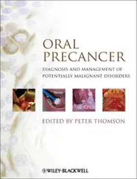 Thomson |  Oral Precancer | eBook | Sack Fachmedien