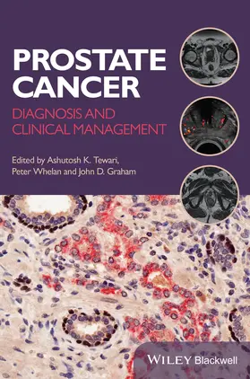 Tewari / Whelan / Graham | Prostate Cancer | Buch | 978-1-118-34735-5 | www.sack.de
