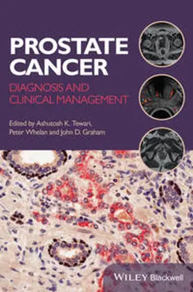 Tewari / Whelan / Graham | Prostate Cancer | E-Book | www.sack.de