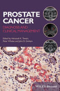 Tewari / Whelan / Graham |  Prostate Cancer | eBook | Sack Fachmedien