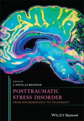 Bremner |  Posttraumatic Stress Disorder | Buch |  Sack Fachmedien