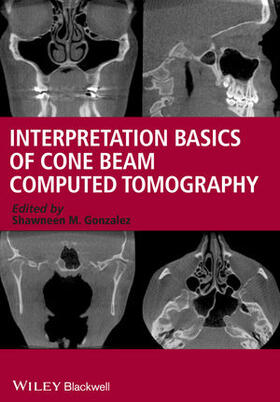 Gonzalez | Interpretation Basics of Cone Beam Computed Tomography | Buch | 978-1-118-38106-9 | sack.de