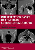 Gonzalez |  Interpretation Basics of Cone Beam Computed Tomography | Buch |  Sack Fachmedien