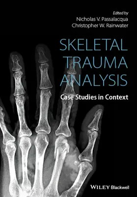 Passalacqua / Rainwater |  Skeletal Trauma Analysis | Buch |  Sack Fachmedien