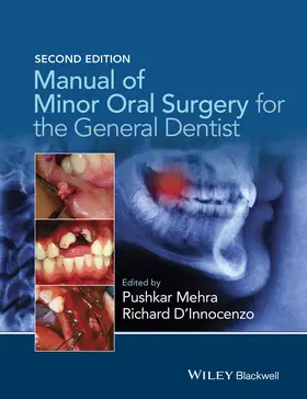 Mehra / D'Innocenzo |  Manual of Minor Oral Surgery for the General Dentist | Buch |  Sack Fachmedien