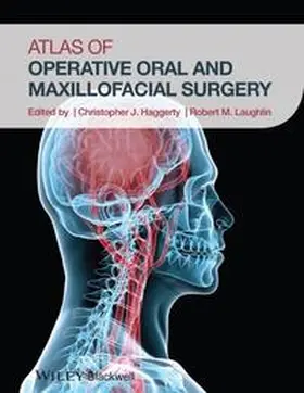 Haggerty / Laughlin |  Atlas of Operative Oral and Maxillofacial Surgery | Buch |  Sack Fachmedien