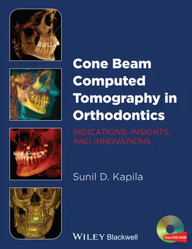 Kapila | Cone Beam Computed Tomography in Orthodontics | Buch | 978-1-118-44848-9 | sack.de
