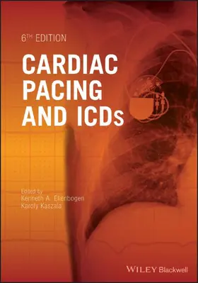 Ellenbogen / Kaszala |  Cardiac Pacing and Icds 6e | Buch |  Sack Fachmedien
