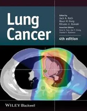 Roth / Hong / Komaki |  Lung Cancer | eBook | Sack Fachmedien