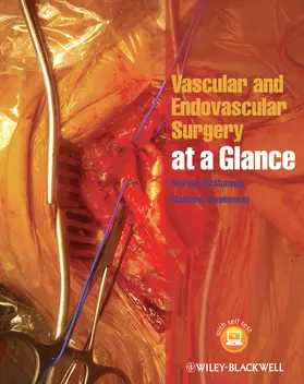 McMonagle / Stephenson | Vascular and Endovascular Surgery at a Glance | Buch | 978-1-118-49603-9 | www.sack.de