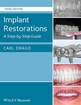 Drago | Implant Restorations: A Step-By-Step Guide | Buch | 978-1-118-51305-7 | sack.de